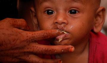 Hunger gnaws at Rohingya children in Bangladesh’s refugee camps